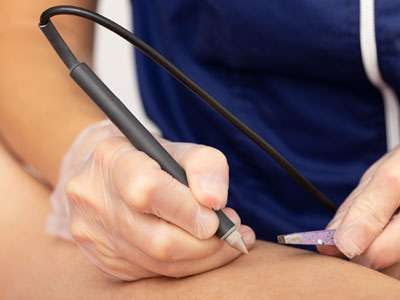 Skin-Clinic-Electrolysis-Feature-Image-1 Skin Clinic Electrolysis Feature Image 1