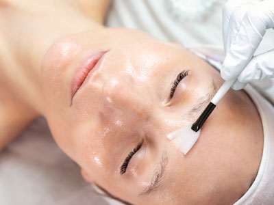Skin-Peel-Chemical-Peel-Skin-Treatment-Main-Feature-Image-1 Skin Peel Chemical Peel Skin Treatment Main Feature Image 1