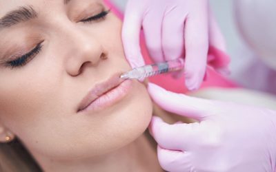 Facial Areas That Can Be Targeted with Fillers