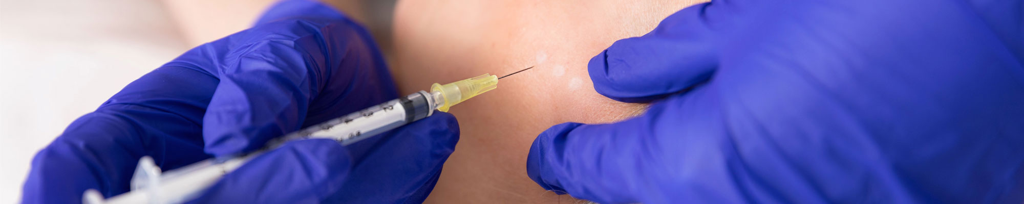 Dermal-Fillers-Main-Feature-Image Dermal Fillers Main Feature Image