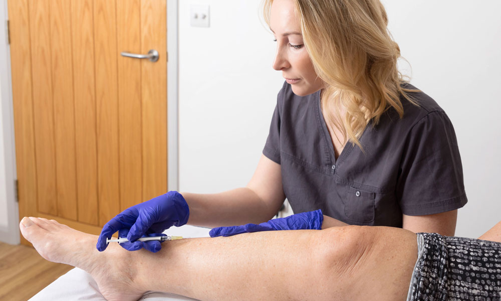 Sclerotherapy Feature Image 1