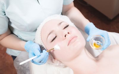 Are Skin Peels Effective?