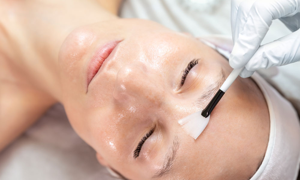 Skin-Peels-Feature-Image-1 Skin Peels Feature Image 1