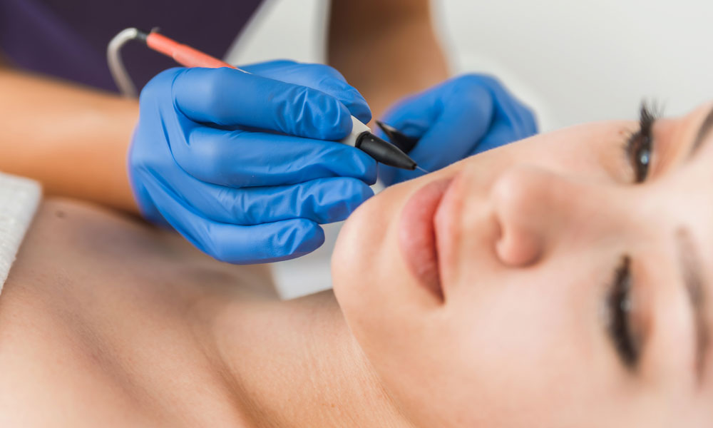 Aesthetic Clinic How Electrolysis Could Be the Answer to Your Skin Issues Blog Image