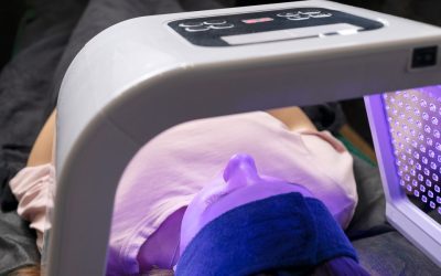 What are Thread Veins and How Can They be Treated?