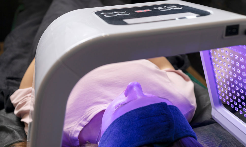 Thread Vein Treatment What are Thread Veins and How Can They be Treated Blog Image