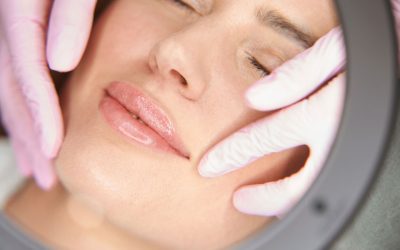 What are Dermal Fillers?