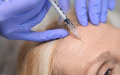 Top Five Reasons to Get Anti-Wrinkle Injections in 2025