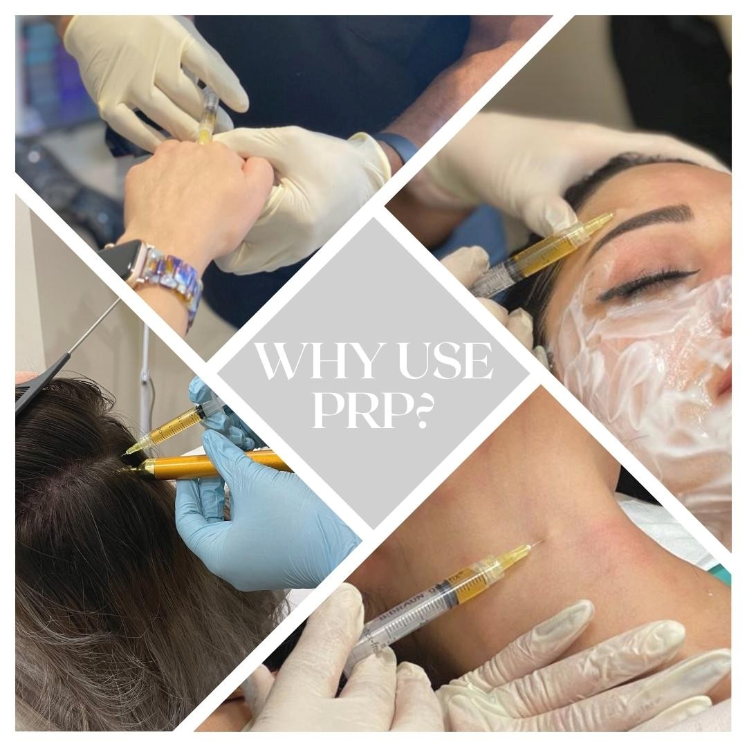 Regenerative Repair Therapy (RRP) Feature Image 3 Regenerative Repair Therapy (RRP) Feature Image 3