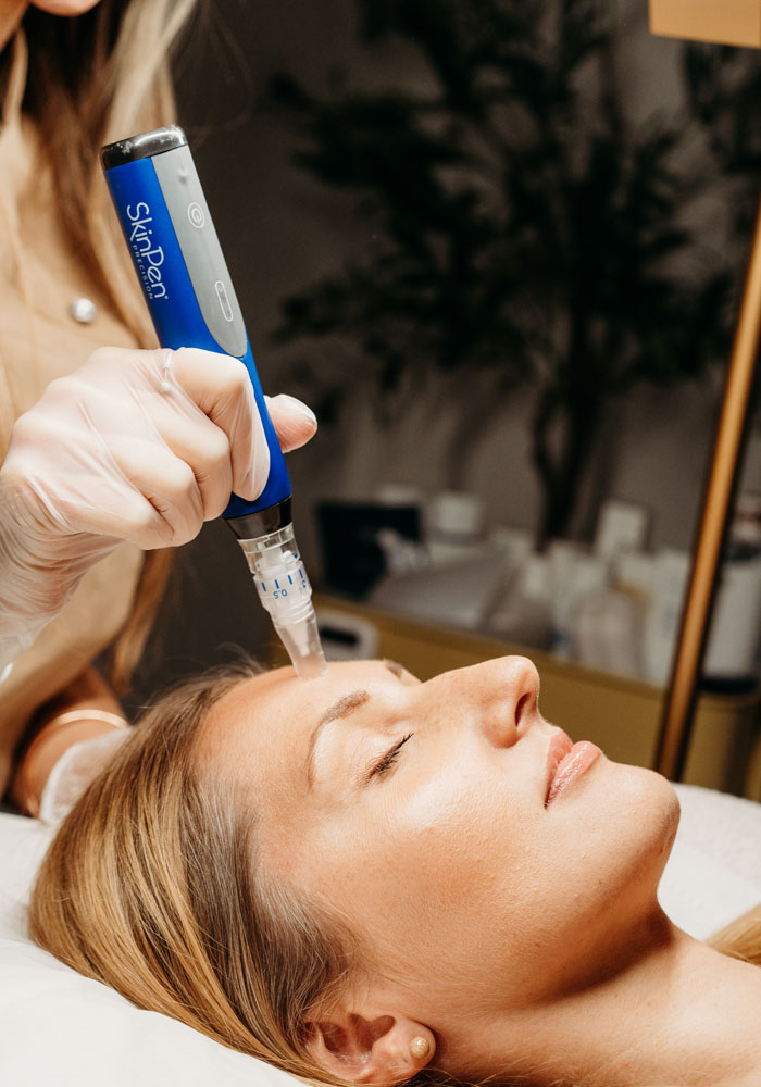 Microneedling-Skin-Clinic-Feature-Image-4 Microneedling Skin Clinic Feature Image 4