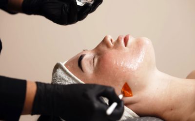 Everything You Need to Know About Skin Peels
