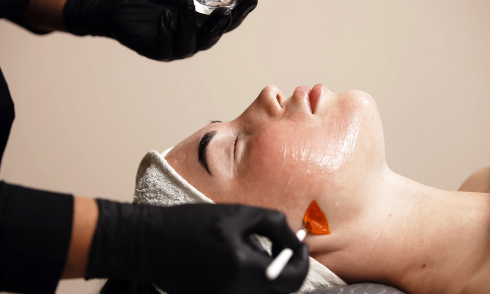 Everything You Need to Know About Skin Peels