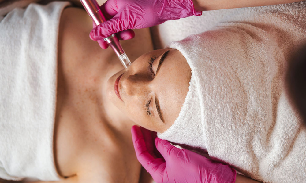 The Role of Microneedling in Skin Rejuvenation Blog Image