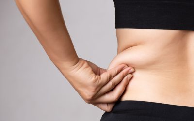 How To Manage Skin Laxity And Volume Loss During Your Weight Loss Journey