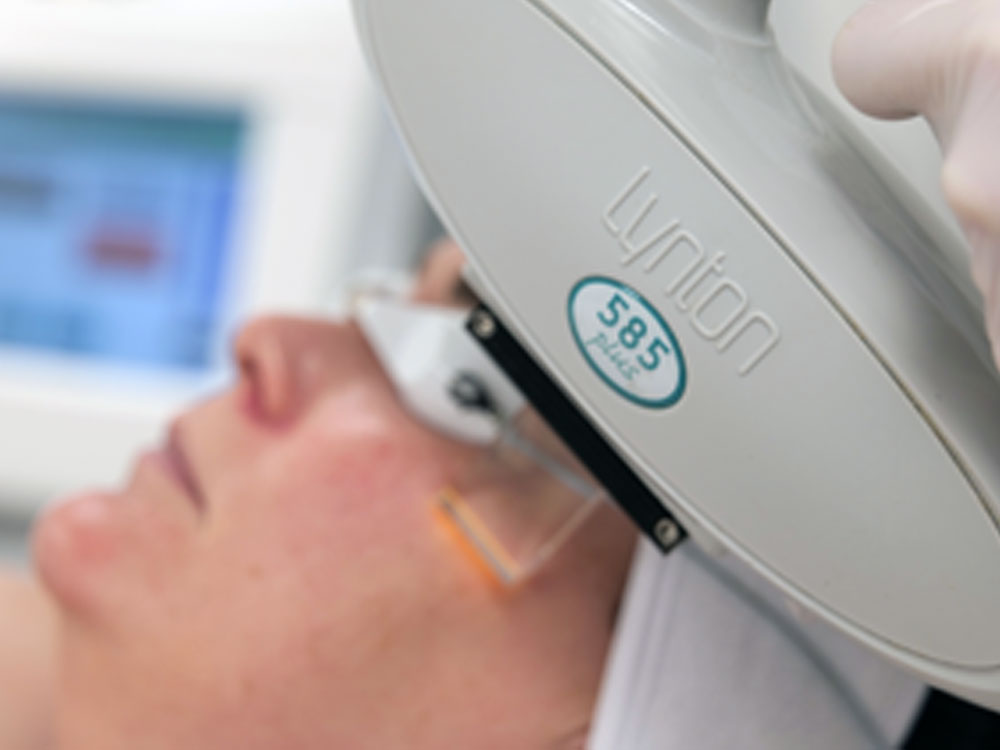 IPL Treatment Skin Nurse Dermatologist Feature Image 4