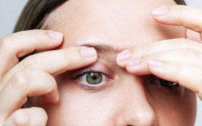 Safe Removal Options for Milia, Skin Tags and Other Small Bumps