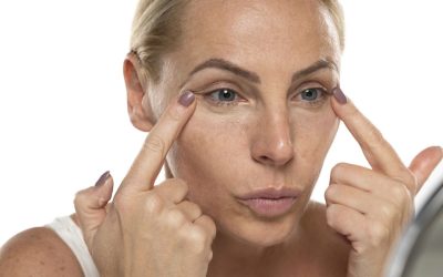 Tired Eyes and Dark Circles & Non-Surgical Options That Actually Help